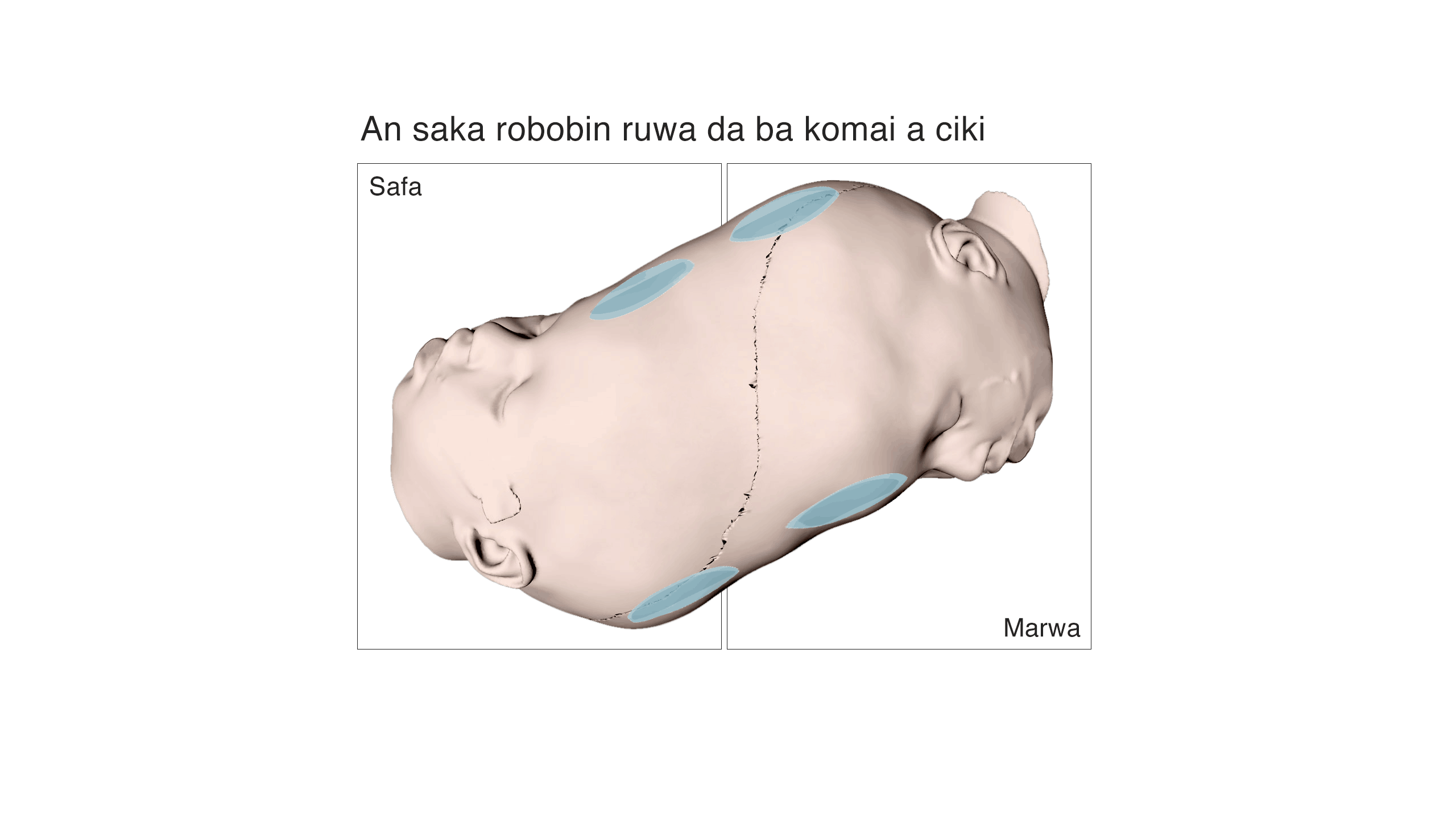 Empty sacks inserted