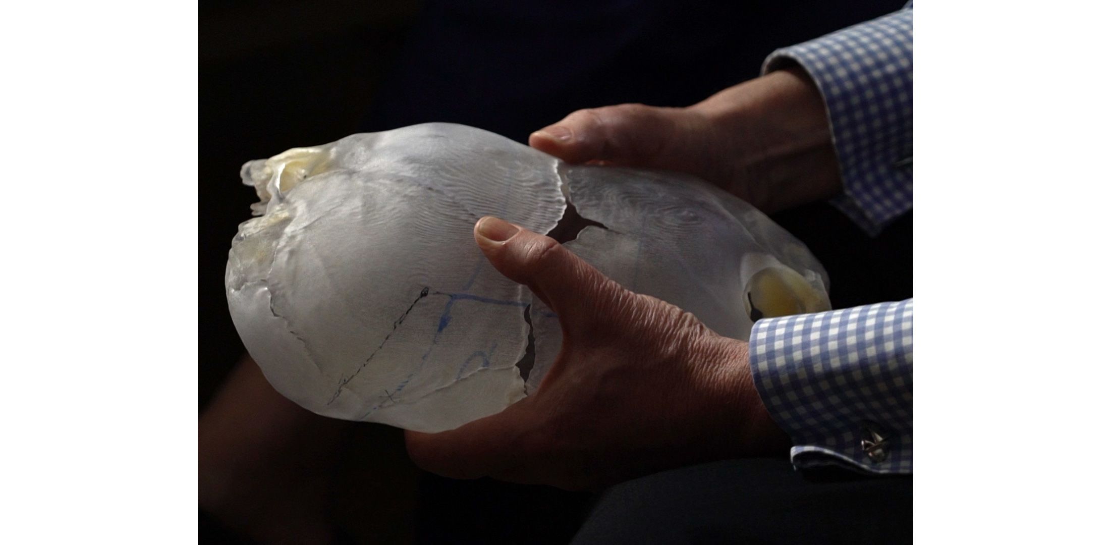 David Dunaway hold models of the twin's skulls