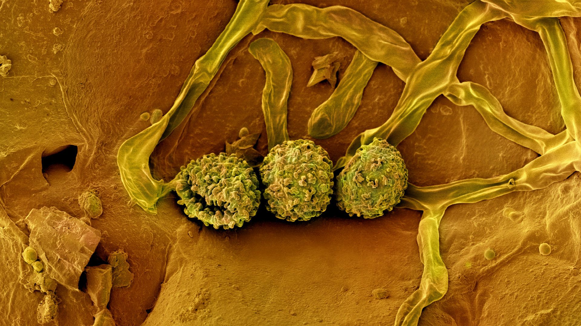Spores seen on the surface of a Coffea humbertii seed
