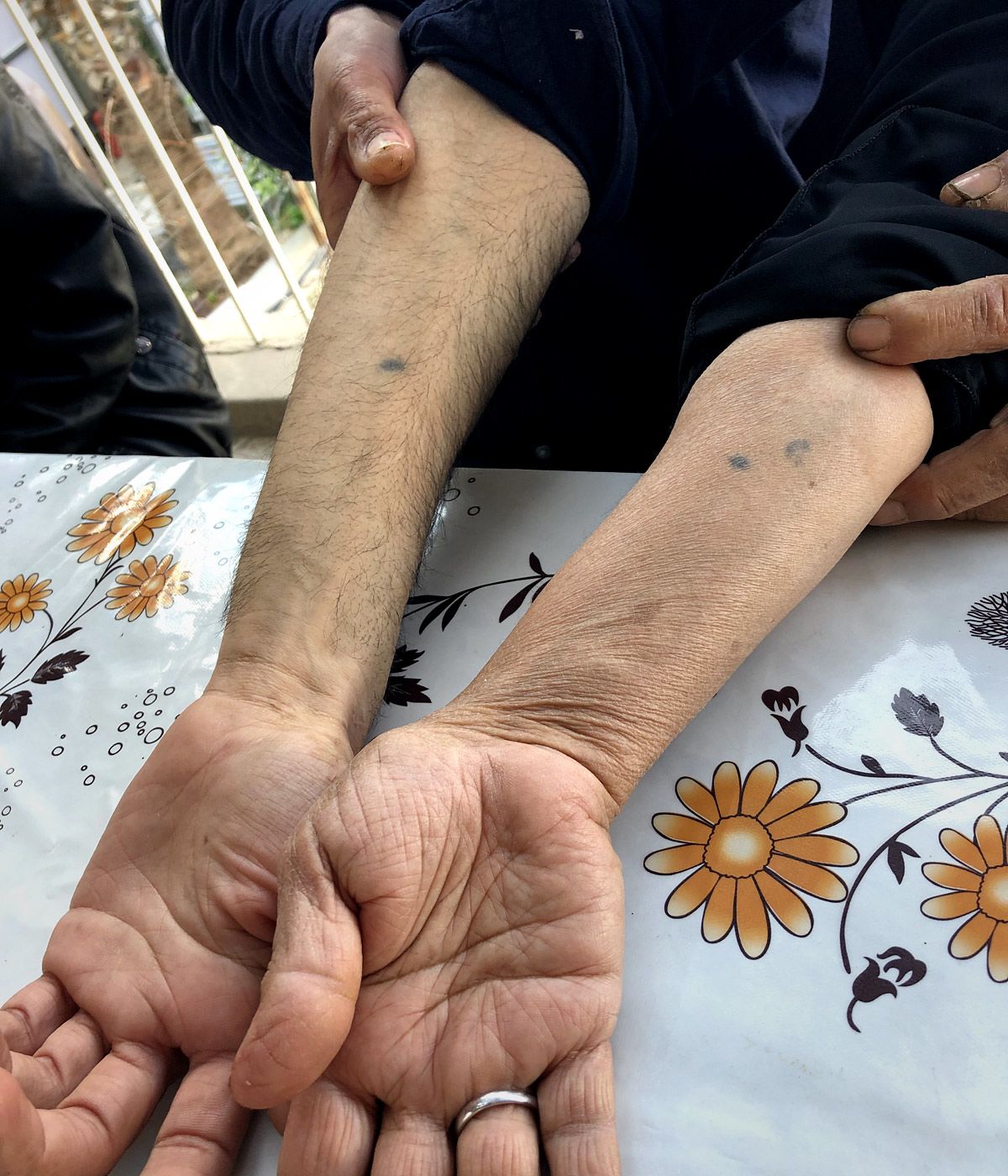 The matching blue dots on Amar and Tahrir's arms