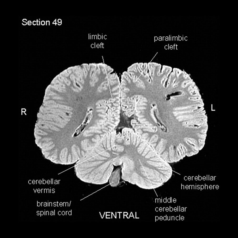 Orca brain