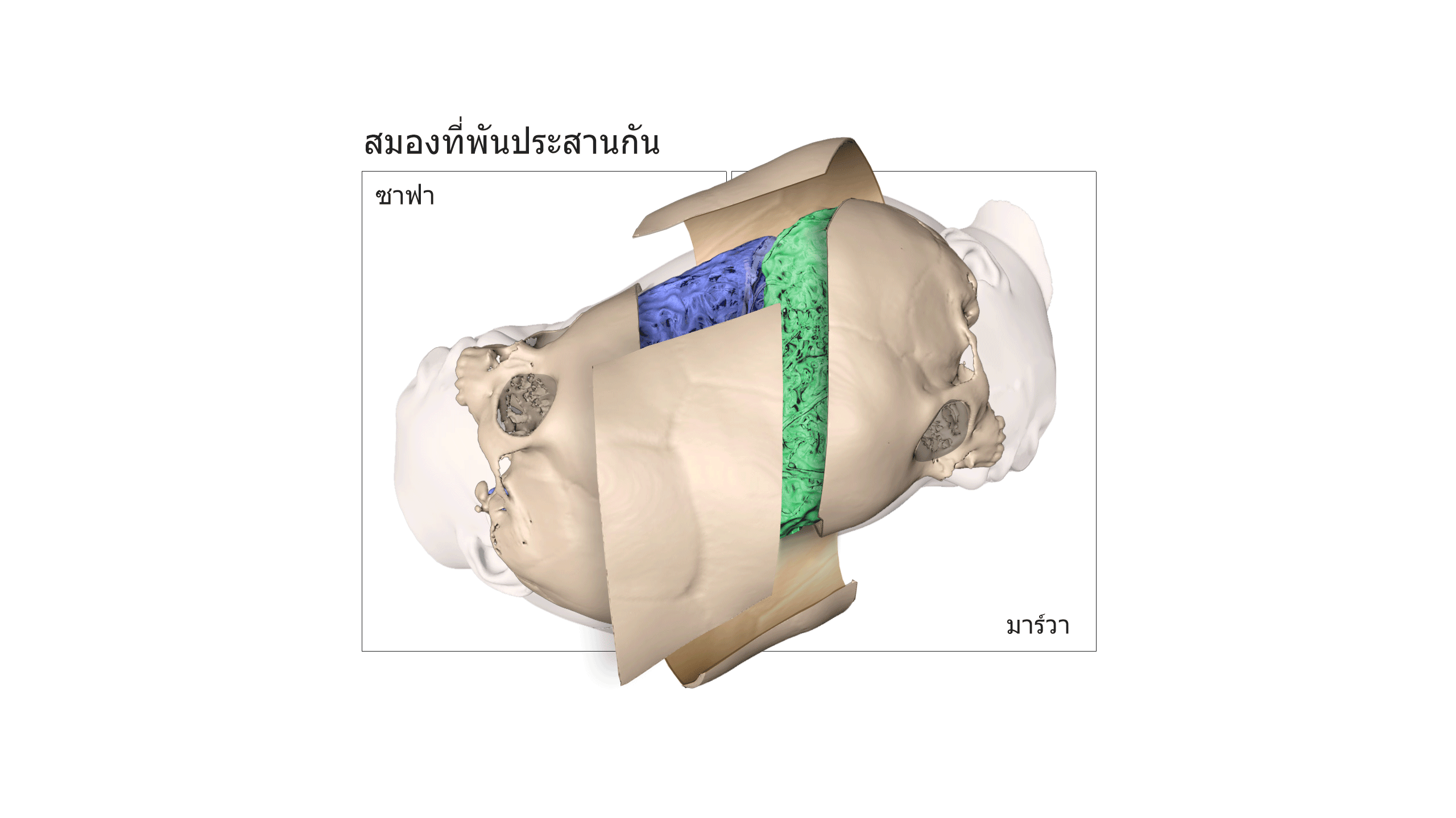 สมองที่พันประสานกัน