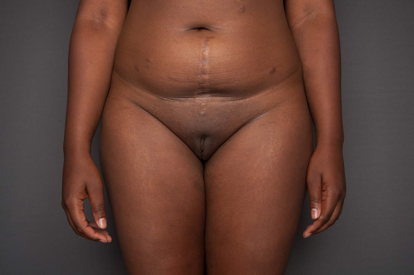 Fat vagins photos Sex massage à Miami