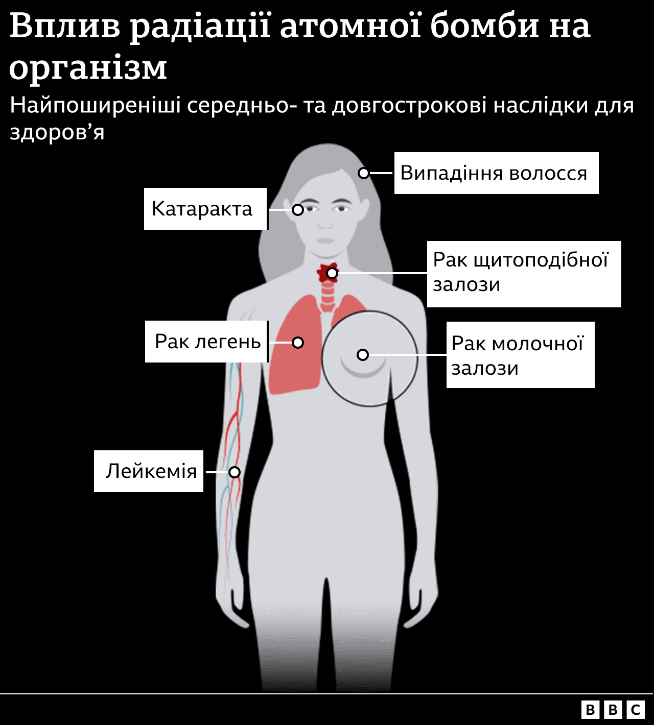Інфографіка, що показує середньо- та довгострокові наслідки радіації: рак грудей, рак легень, рак щитоподібної залози; випадіння волосся; катаракта.