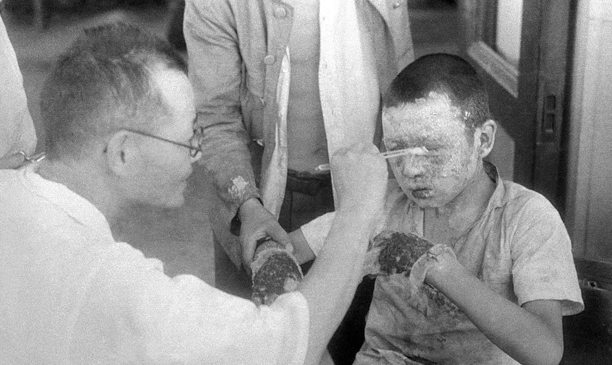 Doctor limpia las heridas de un niño afectado por la bomba nuclear