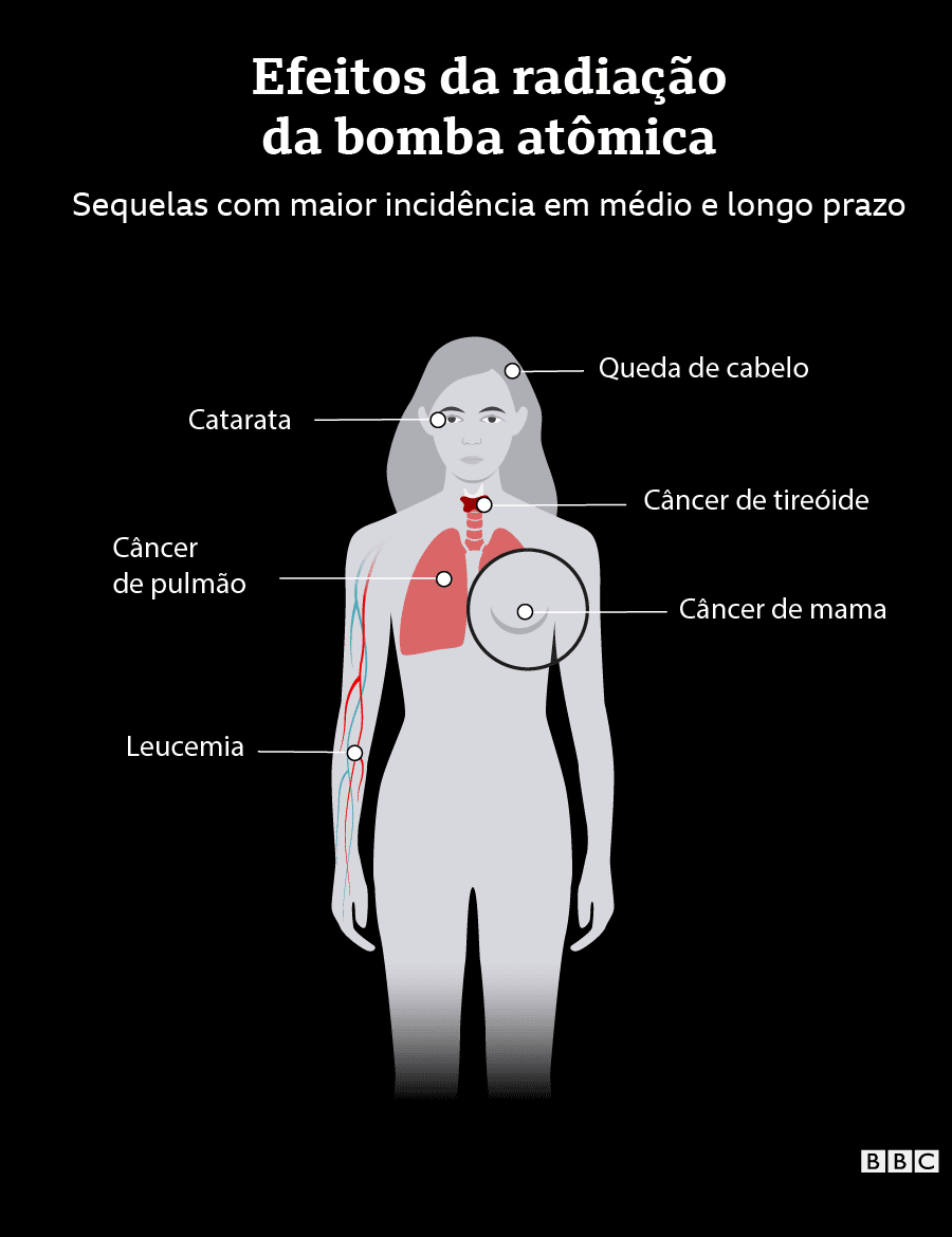 Gráfico sobre os efeitos de médio e longo prazo da radiação no corpo: câncer de mama; de pulmão; de tireóide; queda de cabelo; catarata.
