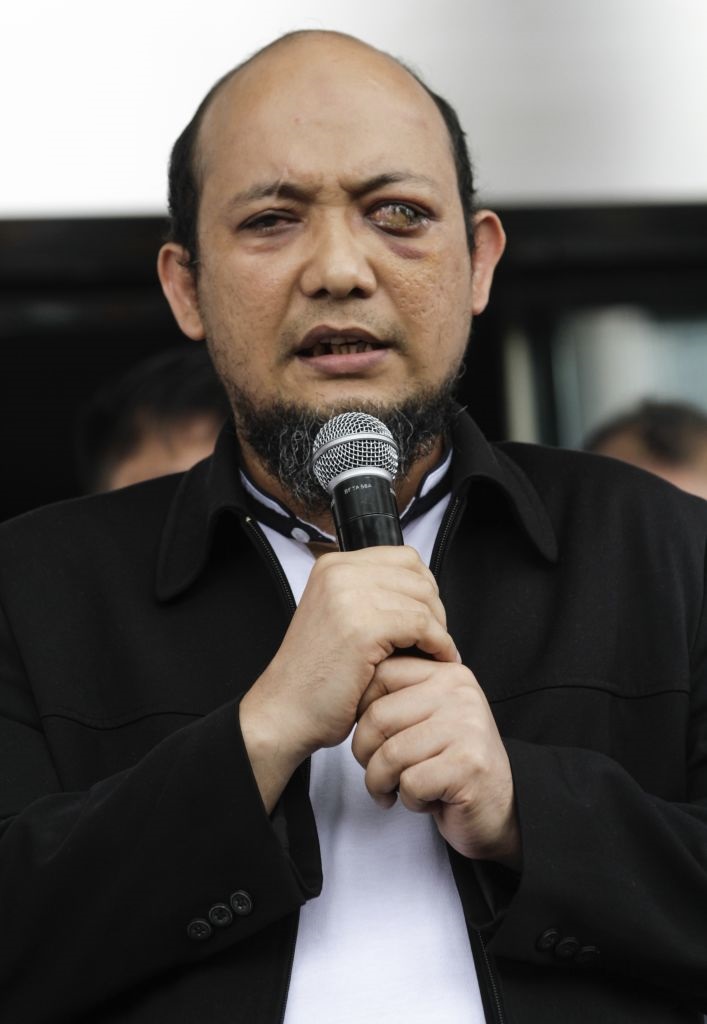 Novel Baswedan jumpa pers saat kembali bekerja di KPK.