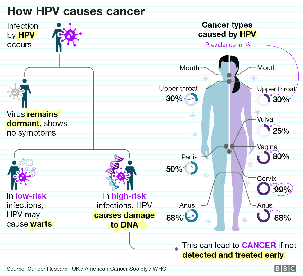 human papillomavirus causes cancer)